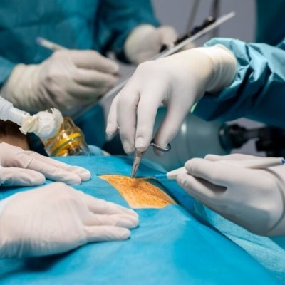 Best General Surgery Hospital in Ecil, Hyderabad